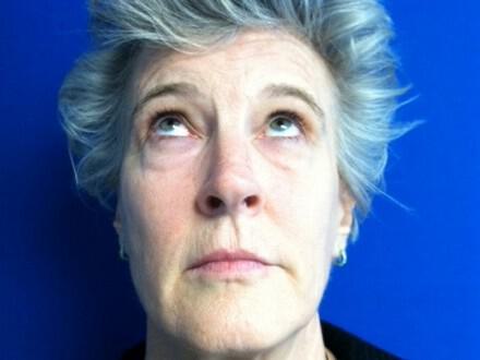 Brow Lift Before & After Image