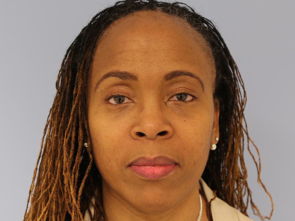 Blepharoplasty Before & After Image