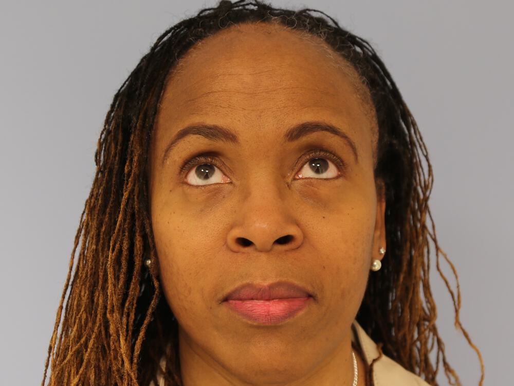 Blepharoplasty Before & After Image