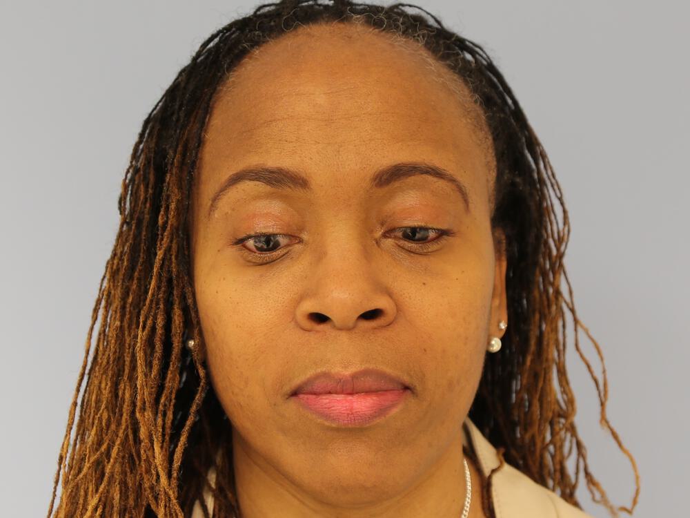 Blepharoplasty Before & After Image