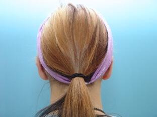 Prominent Ears Before & After Image