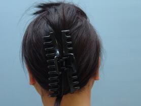 Prominent Ears Before & After Image