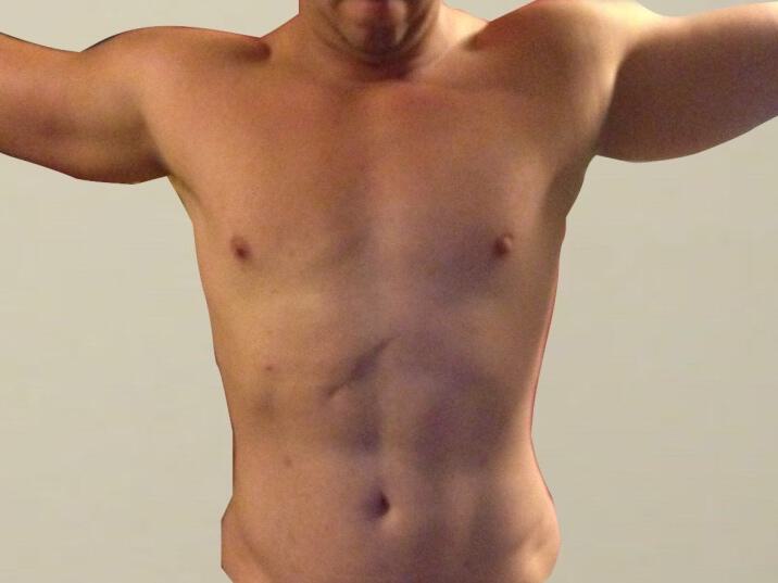 Ab Etching Before & After Image