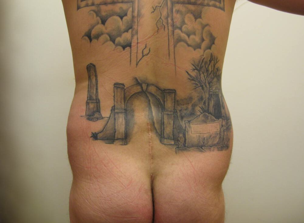 Ab Etching Before & After Image