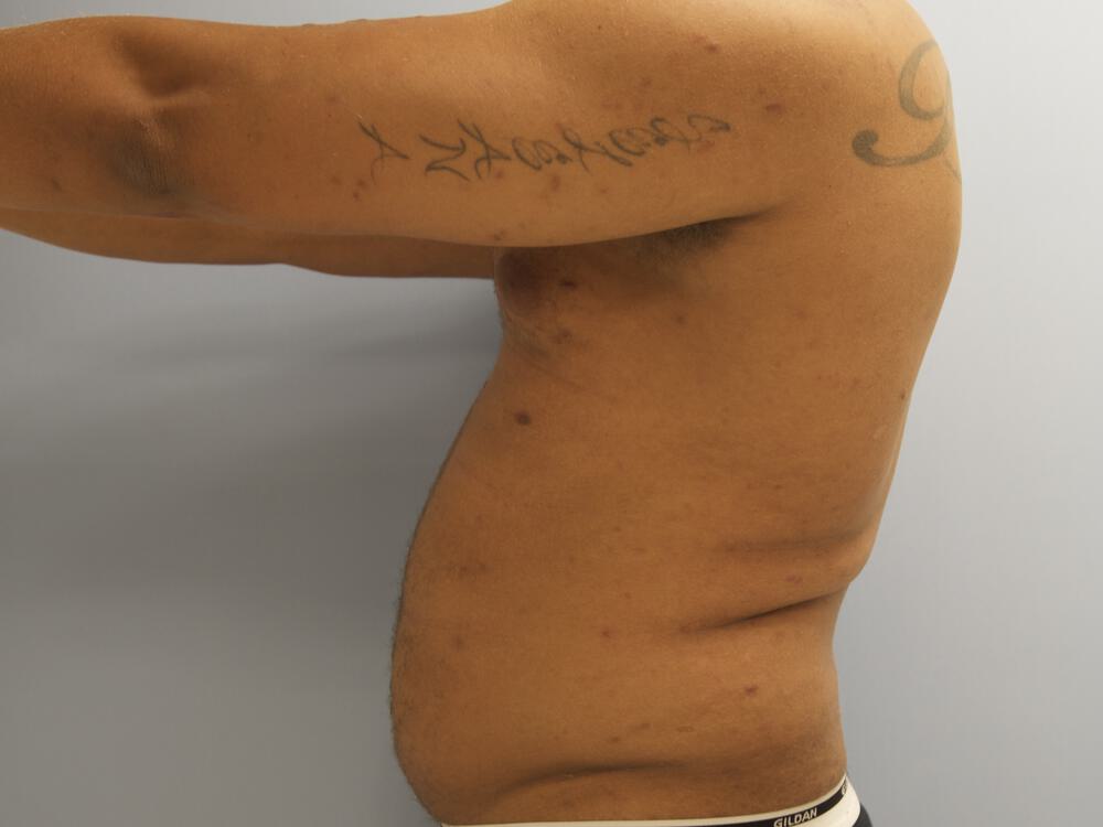 Ab Etching Before & After Image