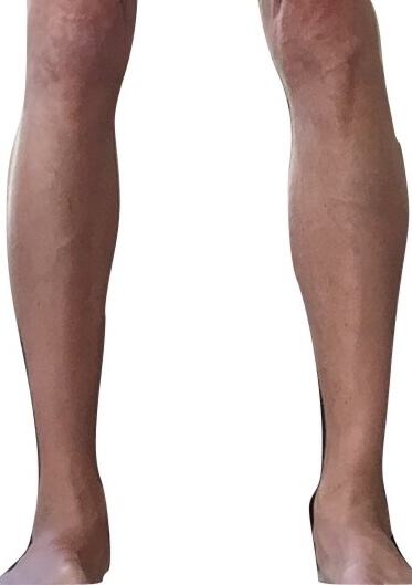 Male Calf Implants Before & After Image