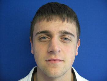 Male Rhinoplasty Before & After Image