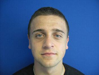 Male Rhinoplasty Before & After Image