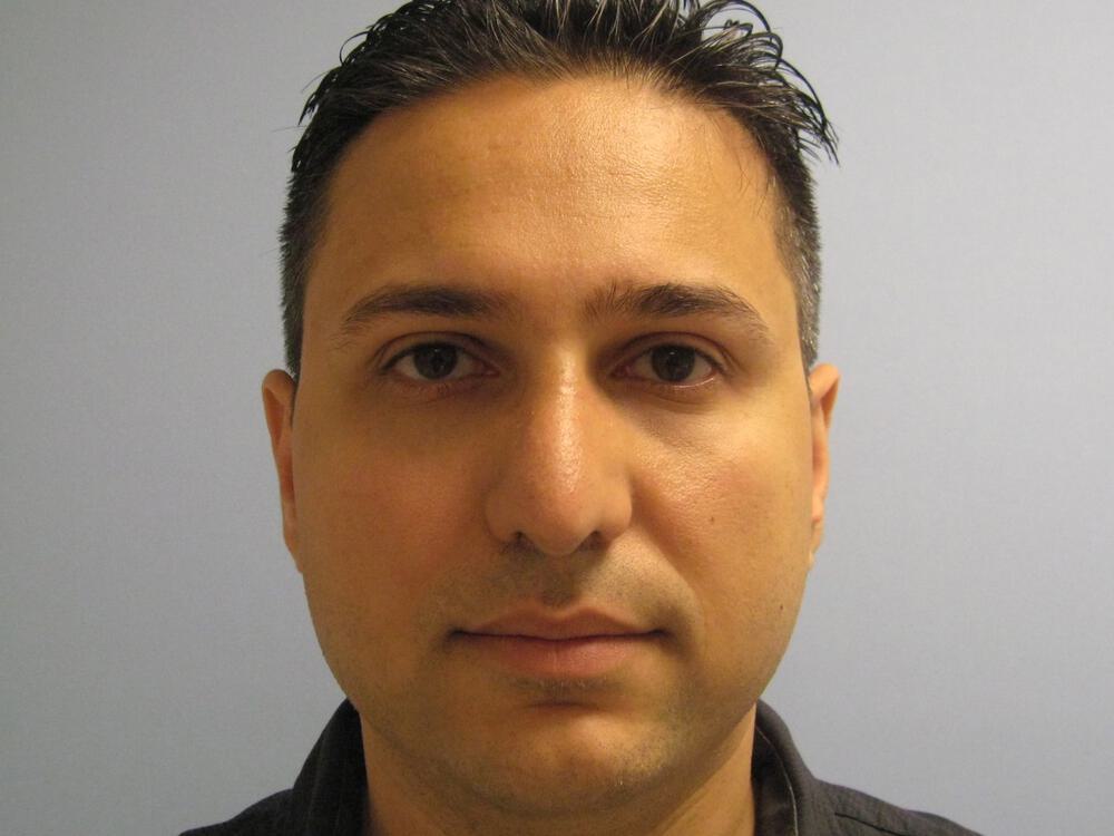 Male Rhinoplasty Before & After Image